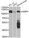 Amphiphysin antibody, STJ27342, St John