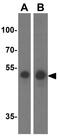 Spt1 antibody, GTX32011, GeneTex, Western Blot image 