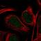 Diacylglycerol Kinase Delta antibody, NBP2-13917, Novus Biologicals, Immunofluorescence image 