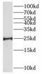 MAX Dimerization Protein 1 antibody, FNab05451, FineTest, Western Blot image 