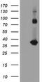 Zinc finger protein SNAI2 antibody, M01615-2, Boster Biological Technology, Western Blot image 