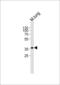 Homeobox protein Hox-A1 antibody, MBS9210264, MyBioSource, Western Blot image 