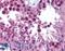 ESET antibody, LS-B720, Lifespan Biosciences, Immunohistochemistry paraffin image 