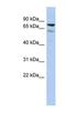 Uncharacterized protein C1orf103 antibody, NBP1-56659, Novus Biologicals, Western Blot image 