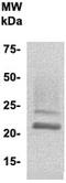 Placenta Enriched 1 antibody, TA354760, Origene, Western Blot image 