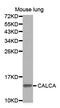 Calcitonin antibody, MBS2525769, MyBioSource, Western Blot image 