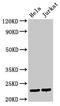 PTTG1 Regulator Of Sister Chromatid Separation, Securin antibody, LS-C672856, Lifespan Biosciences, Western Blot image 