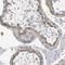 Vesicle Associated Membrane Protein 8 antibody, NBP1-84013, Novus Biologicals, Immunohistochemistry frozen image 