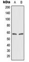 Solute Carrier Family 2 Member 2 antibody, LS-B15821, Lifespan Biosciences, Western Blot image 