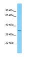 Olfactory Receptor Family 51 Subfamily F Member 2 antibody, orb327069, Biorbyt, Western Blot image 