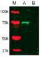 Matrix Metallopeptidase 2 antibody, GTX25704, GeneTex, Western Blot image 