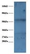 Small Nuclear Ribonucleoprotein Polypeptide A antibody, LS-C211015, Lifespan Biosciences, Western Blot image 