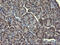 Mitogen-activated protein kinase 13 antibody, M03594, Boster Biological Technology, Immunohistochemistry paraffin image 