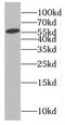 RAB Guanine Nucleotide Exchange Factor 1 antibody, FNab07059, FineTest, Western Blot image 