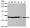Protein Inhibitor Of Activated STAT 2 antibody, NBP2-19819, Novus Biologicals, Western Blot image 