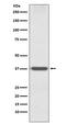 Homeobox protein OTX1 antibody, M05601, Boster Biological Technology, Western Blot image 