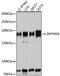 Zinc Finger MYND-Type Containing 8 antibody, GTX35242, GeneTex, Western Blot image 