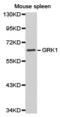 GRK1 antibody, TA327459, Origene, Western Blot image 