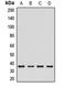 Charged Multivesicular Body Protein 4B antibody, orb412600, Biorbyt, Western Blot image 