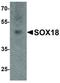 SRY-Box 18 antibody, LS-C336195, Lifespan Biosciences, Western Blot image 