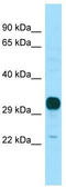 Neuropeptides B And W Receptor 1 antibody, TA338160, Origene, Western Blot image 