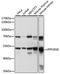Protein Phosphatase 2 Regulatory Subunit B'Epsilon antibody, LS-C750060, Lifespan Biosciences, Western Blot image 