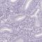 Solute carrier family 45 member 3 antibody, HPA019075, Atlas Antibodies, Immunohistochemistry frozen image 