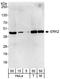 Mitogen-Activated Protein Kinase 1 antibody, A302-061A, Bethyl Labs, Western Blot image 