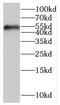 Homeostatic Iron Regulator antibody, FNab03851, FineTest, Western Blot image 