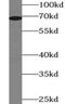 Matrix Metallopeptidase 9 antibody, FNab05247, FineTest, Western Blot image 