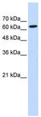 Eukaryotic Translation Initiation Factor 2D antibody, TA345988, Origene, Western Blot image 
