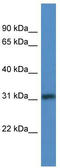 Transforming Growth Factor Beta Regulator 1 antibody, TA343011, Origene, Western Blot image 