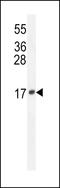 Lipocalin 10 antibody, LS-C165719, Lifespan Biosciences, Western Blot image 