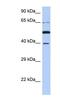 PNMA Family Member 3 antibody, NBP1-52929, Novus Biologicals, Western Blot image 