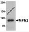 Mitofusin 2 antibody, 7863, ProSci Inc, Western Blot image 