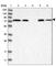 Alpha Fetoprotein antibody, HPA023600, Atlas Antibodies, Western Blot image 