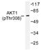 Akt antibody, AP01522PU-N, Origene, Western Blot image 