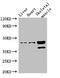Acyl-CoA Dehydrogenase Family Member 8 antibody, orb39083, Biorbyt, Western Blot image 