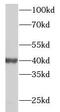 RP2 Activator Of ARL3 GTPase antibody, FNab09990, FineTest, Western Blot image 