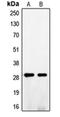 Fibroblast Growth Factor 5 antibody, orb213926, Biorbyt, Western Blot image 