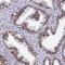 Zinc Finger Protein 280A antibody, PA5-60724, Invitrogen Antibodies, Immunohistochemistry paraffin image 