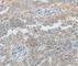 Piwi-like protein 2 antibody, A3073, ABclonal Technology, Immunohistochemistry paraffin image 