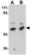 Matrilin 3 antibody, GTX85286, GeneTex, Western Blot image 