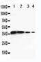 DEAD-Box Helicase 6 antibody, PA5-79149, Invitrogen Antibodies, Western Blot image 