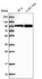 A-Kinase Anchoring Protein 8 Like antibody, PA5-59993, Invitrogen Antibodies, Western Blot image 