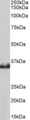 Capping Actin Protein, Gelsolin Like antibody, 43-522, ProSci, Enzyme Linked Immunosorbent Assay image 