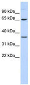 Epsin 2 antibody, TA329768, Origene, Western Blot image 