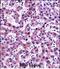 Nicotinamide N-Methyltransferase antibody, A02676-1, Boster Biological Technology, Immunohistochemistry paraffin image 