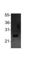 BCL2 antibody, NB100-56101, Novus Biologicals, Western Blot image 
