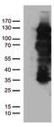 Progesterone Receptor antibody, TA805294, Origene, Western Blot image 